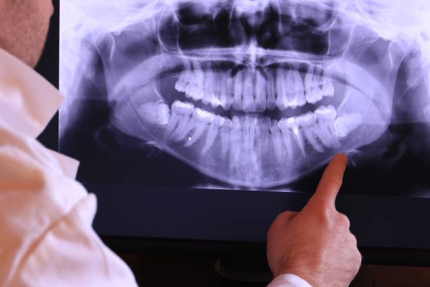 Best Weekend Emergency Dental Services in Carpentersvle, IL